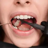 Tooth Filling