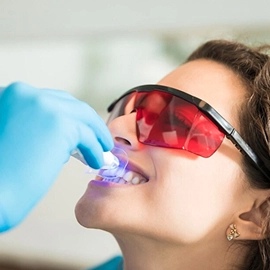 Teeth Whitening