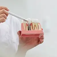 Dental Implant