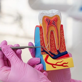 Root Canal Treatment